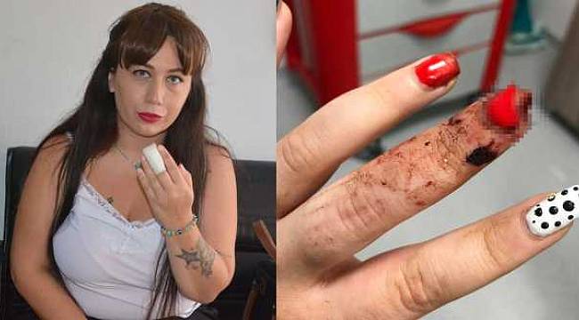 Yemeğe gittiği köftecide parmağı koptu