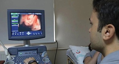 Sinop'ta 4 boyutlu ultrason cihazı hizmete alındı